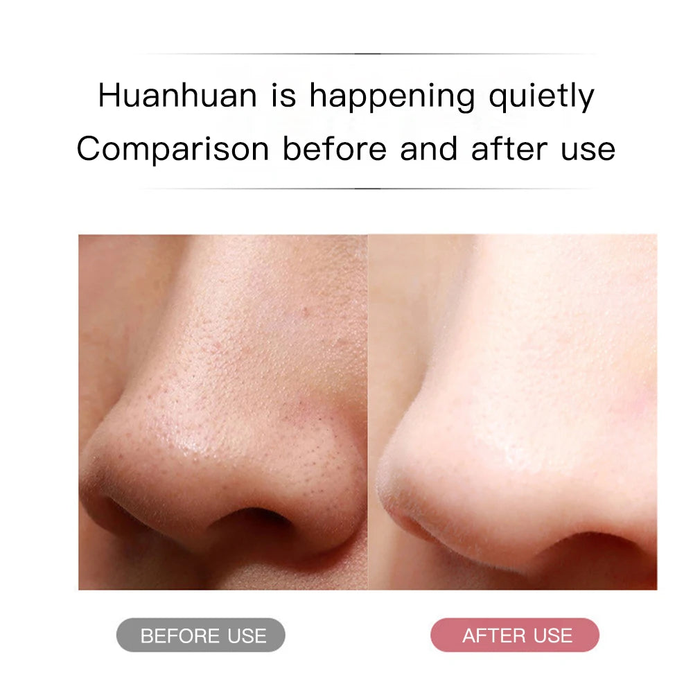 Electric Ultrasonic Skin Scrubber – Facial Cleansing & Blackhead Remover Spatula