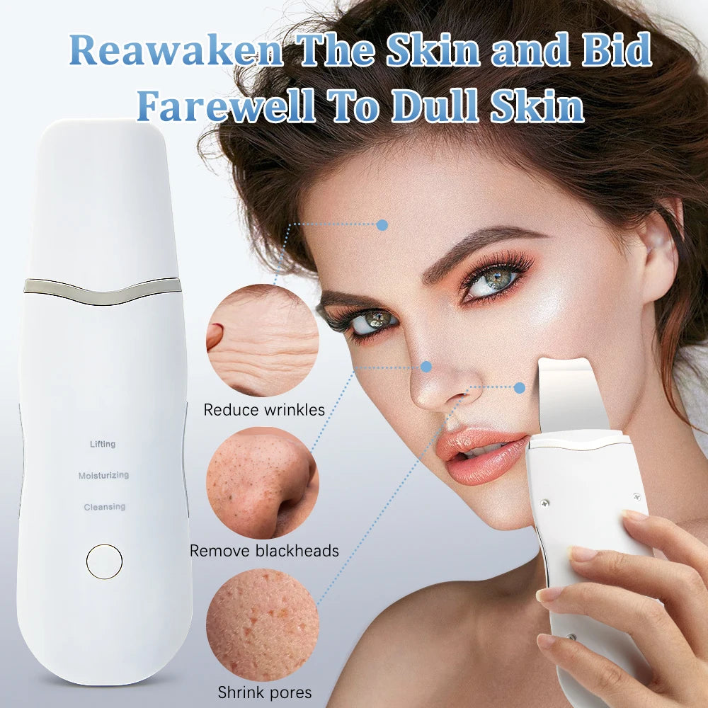 Electric Ultrasonic Skin Scrubber – Facial Cleansing & Blackhead Remover Spatula