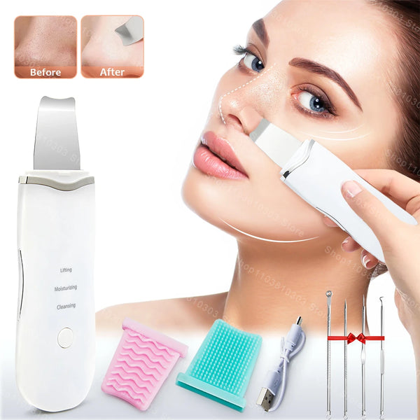 Electric Ultrasonic Skin Scrubber – Facial Cleansing & Blackhead Remover Spatula