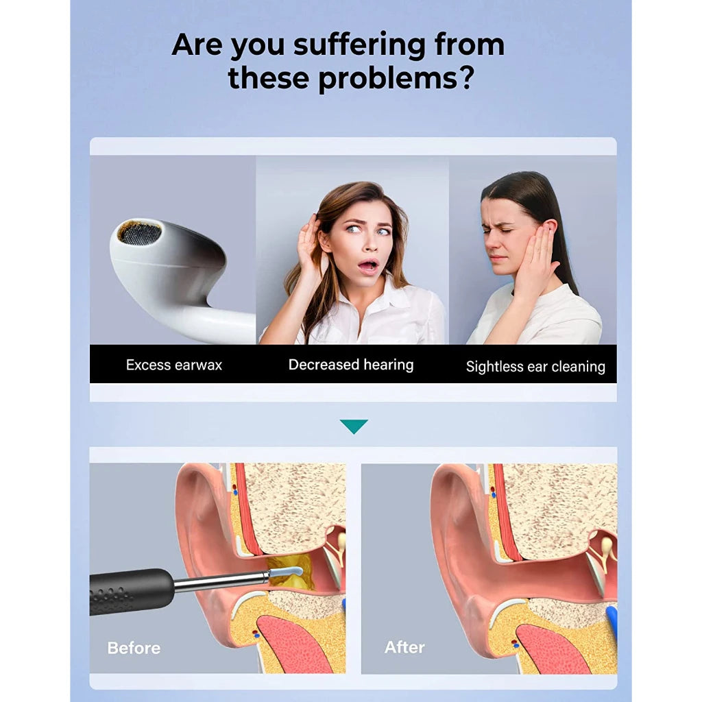 Bebird R1+ R3 T15 M9S Smart Visual Ear Cleaner with 3.5mm Camera – Ear Wax Remover Kit