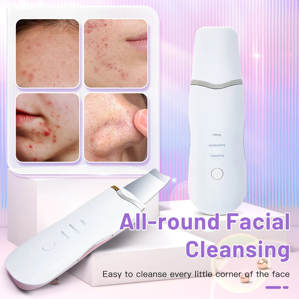 Electric Ultrasonic Skin Scrubber – Facial Cleansing & Blackhead Remover Spatula
